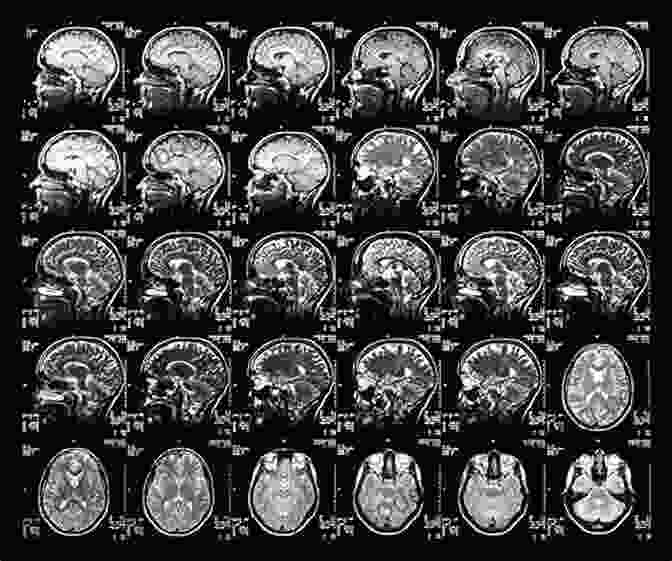 Series Of MRI Scans Showing Brain Development From Infancy To Adulthood Defining Autism: A Guide To Brain Biology And Behavior